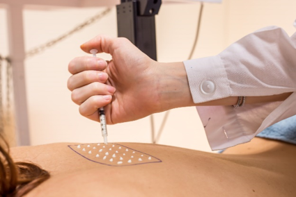 Immagine di una donna sdraiata di schiena mentre le viene applicato un test solare, simbolo dell’articolo del blog dedicato ai test clinici nel makeup: un vantaggio competitivo perchè sono fondamentali per i brand beauty, della business unit cosmetic & medical device di Lifeanalytics